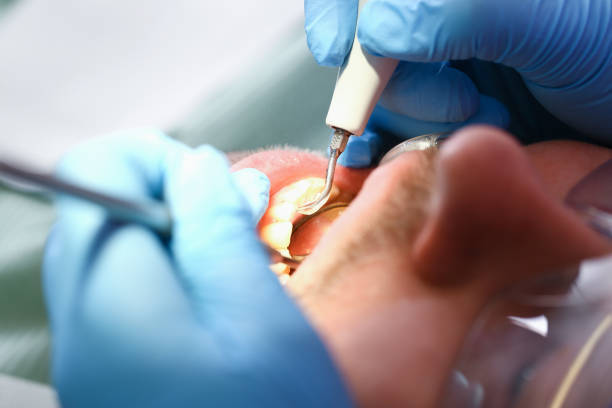 Best Walk-In Emergency Dentist in Kershaw, SC